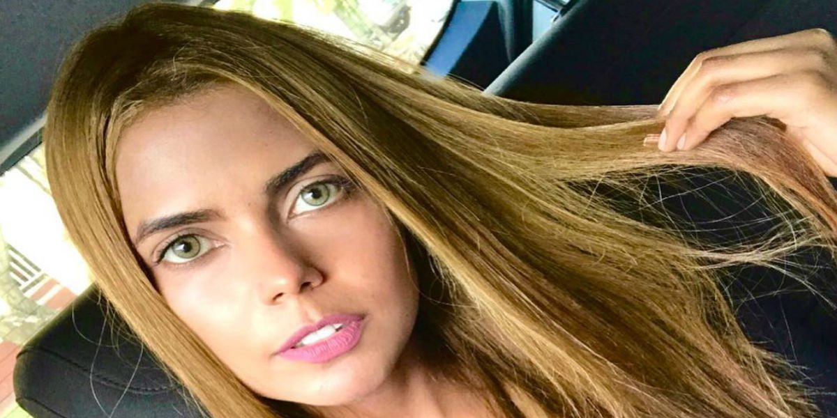 La extraña enfermedad en la piel de Tahiana Bueno