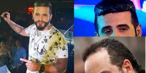 Cabello del cantante de vallenato Nelson Velásquez
