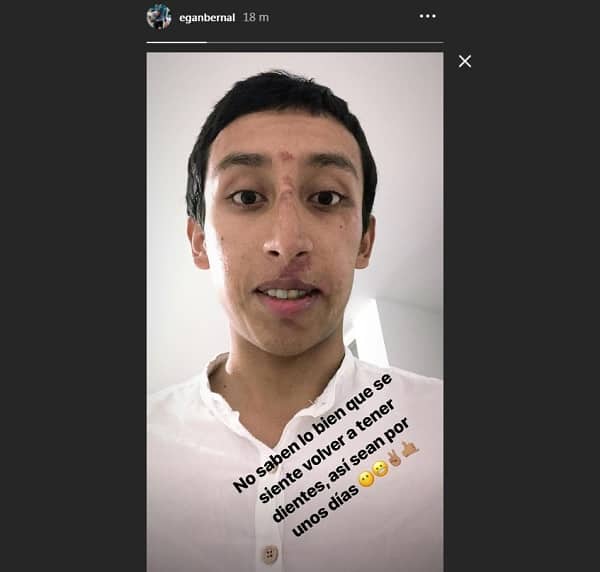 Así quedó Egan Bernal luego de que le practicaran varias cirugías faciales