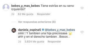 Daniela Ospina responde sobre sus estrías en los senos.