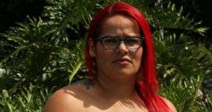 El caso de Paula Andrea Moreno, cuya cirugía plástica realizada por Alfredo Patrón resultó ser una pesadilla