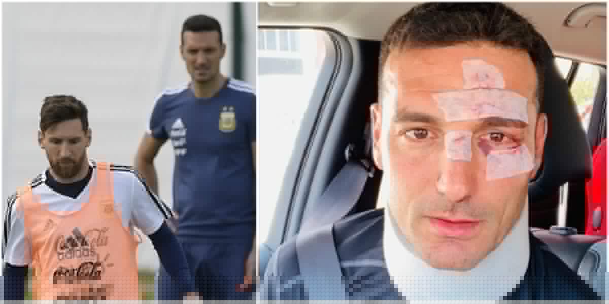 lionel scaloni accidente bicicleta seleccion argentina